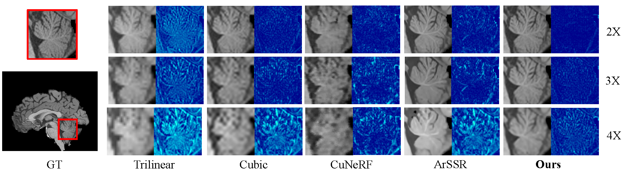 Cross-domain qualitative comparison on HCP