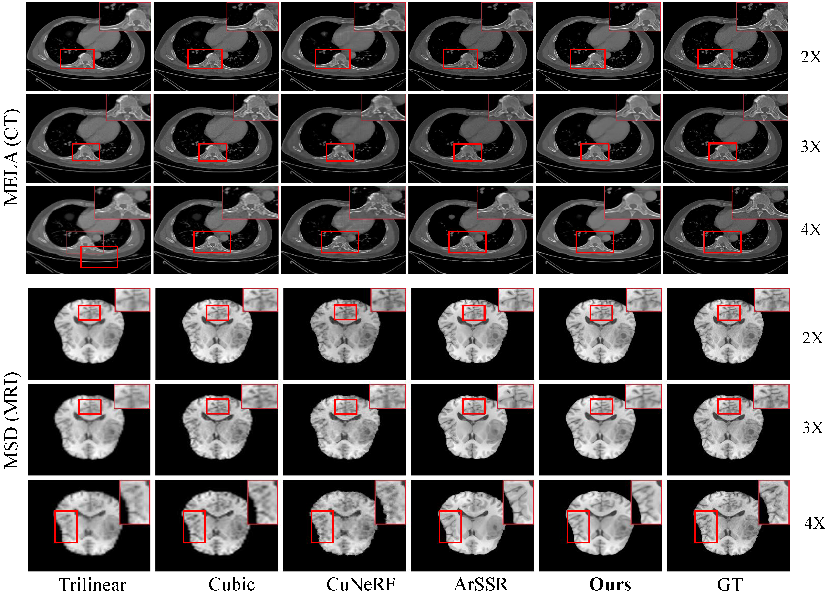 In-domain qualitative comparison on MELA CT and MSD MRI