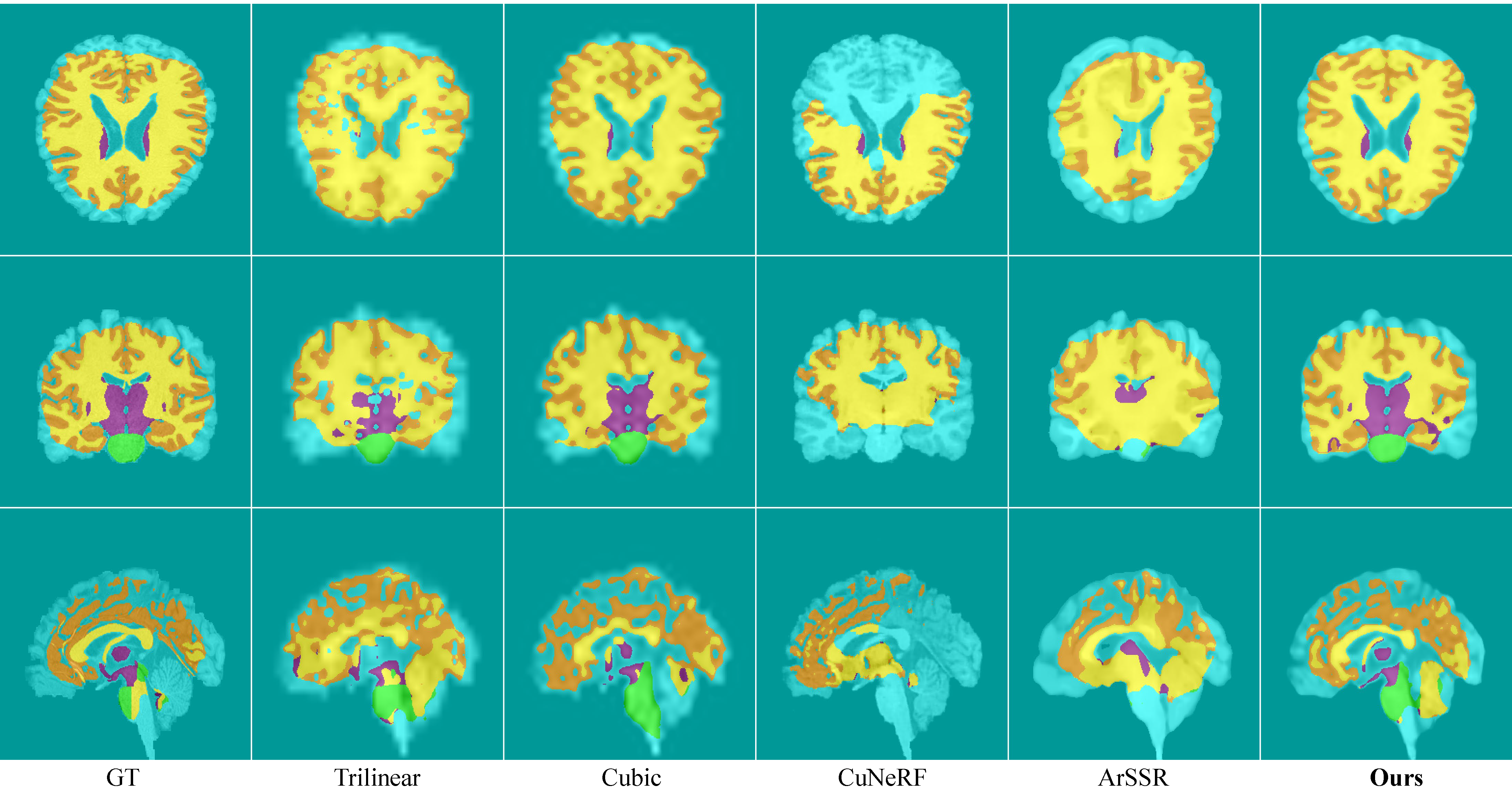 Clinical validation under 8x cross-domain super-resolution